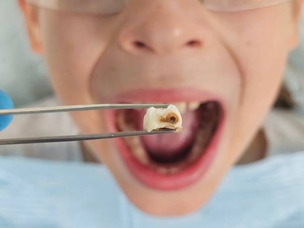 Best 24-Hour Emergency Dentist in Mount Airy, GA